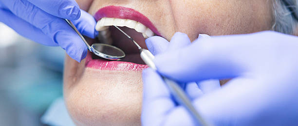 Best Emergency Broken Tooth Repair in New Sarpy, LA